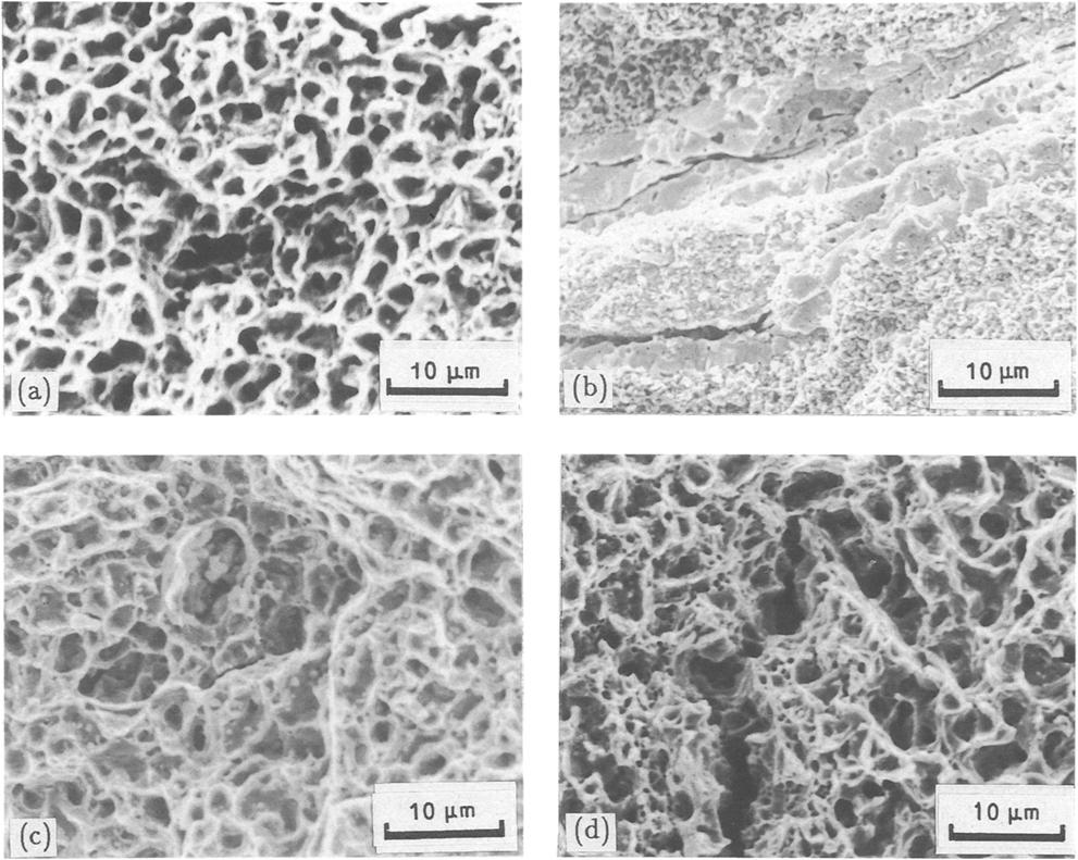 Figure 5 SEM photomicrographs of metal matrix at the fracture surface for (a) specimen A, (b) specimen B, (c) specimen C, (d) specimen D, (e) specimen E.