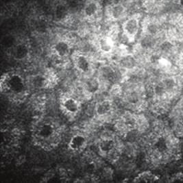 Stratum corneum, 0 μm depth: strong autofluorescence coming from keratin and corneocytes, hexagonal-shaped flat cells.