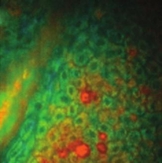 values (keratinocytes appear green-blue and melanin containing keratinocytes and melanocytes appear yellow-red).