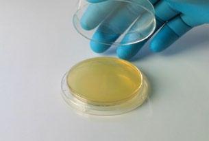Contact agar plates are simply pressed onto the surface or glove fingertips, incubated, and colonies are counted.