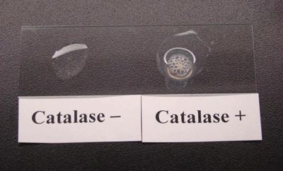Indole production test - 3. MR test + 4. VP test - 5. Catalase test + 6.