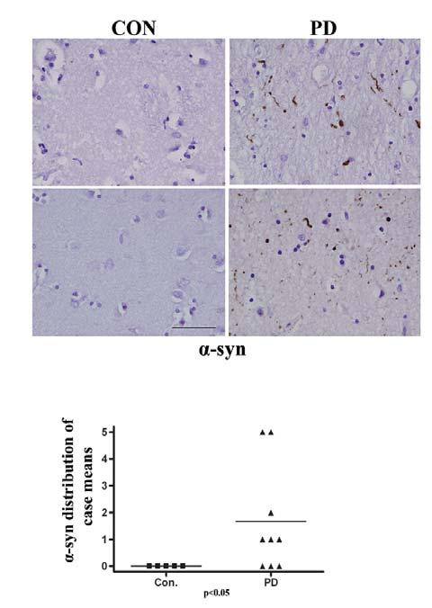 Fig. S7. Levels of α-synuclein in brains of Parkinson s disease patients.