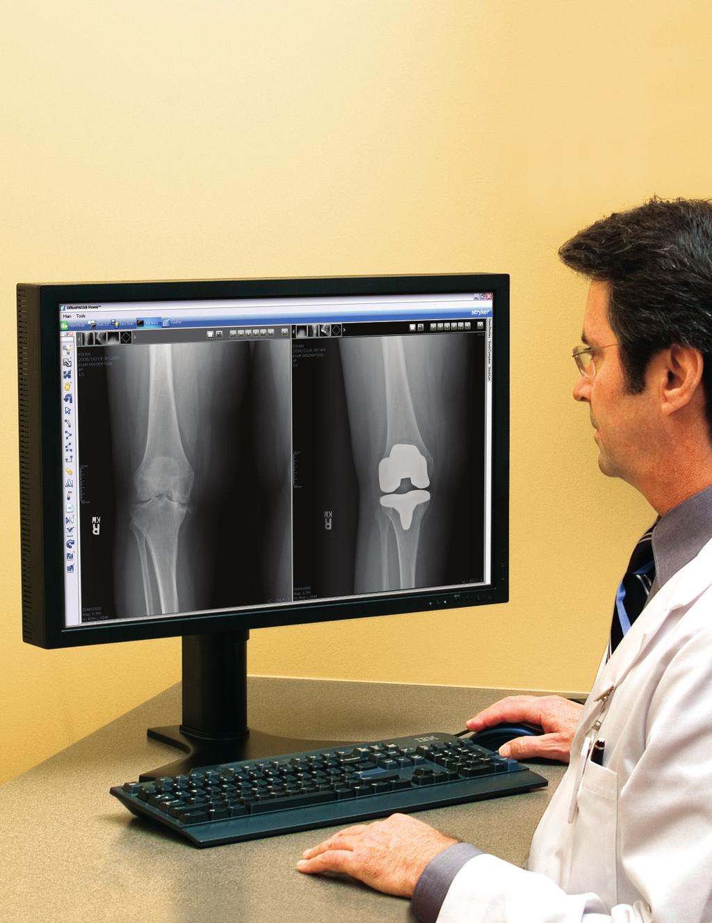 Our Focus is Orthopaedics Our solutions have a single goal to make life easier for orthopaedic surgeons.