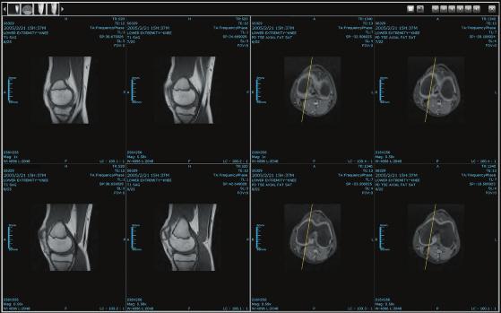 QuickCompare Compare multiple studies in a single click. 1 Print DICOM Images Easily preview and select an image for standard or inverse printing.