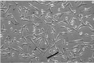 12 Slika 6: Mezenhimske matične celice izolirane iz popkovnične krvi (Lee in sod, 2004) Zelo malo je bilo do zdaj napisanega o izolaciji, karakterizaciji in diferenciaciji MMC iz popkovnične krvi.