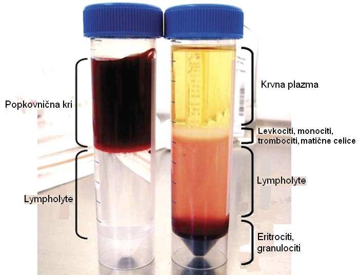 23 ml centrifugurke nanesli 12,5 ml na sobno temperaturo segretega Lympholyte -H, nanj pa 25 ml razredčene popkovnične krvi. Pri tem smo morali paziti, da se fazi med seboj nista pomešali.