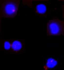 Modra barva prikazuje celična jedra, rdeča pa obarvane adherentne celice CD34+, ki imajo izražen celični označevalec