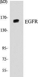 Anti-EGFR Antibody The Anti-EGFR Antibody is a rabbit polyclonal antibody. It was tested on Western Blots for specificity.
