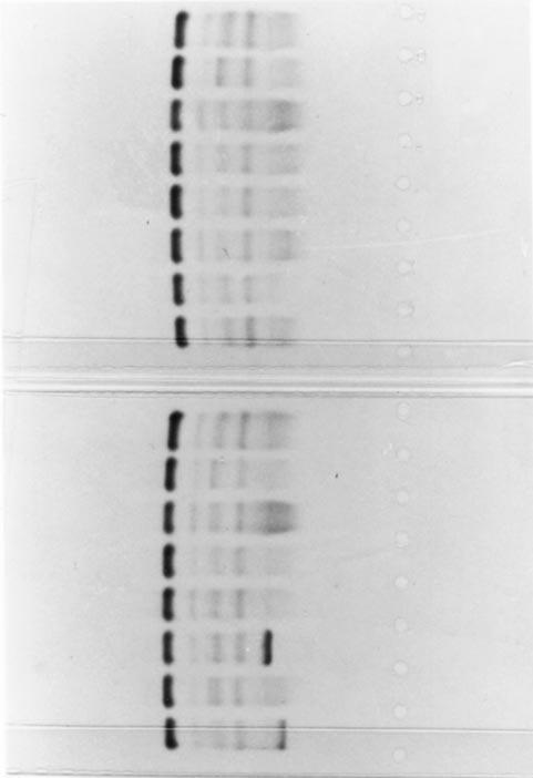 946 Bossuyt et al.: Serum protein electrophoresis Fig. 1. Agarose protein electrophoresis using Hydrasys was performed on 30 samples from hospitalized patients as described in Materials and Methods.