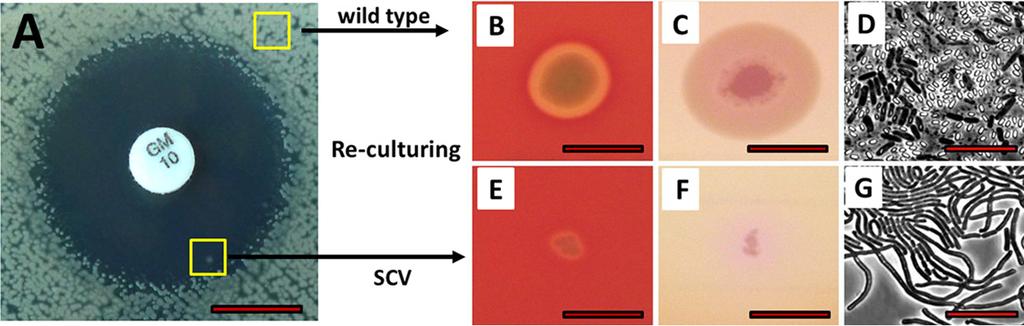Frenzel et al. FIG 1 Detection and phenotypes of small colony variants of B. cereus.