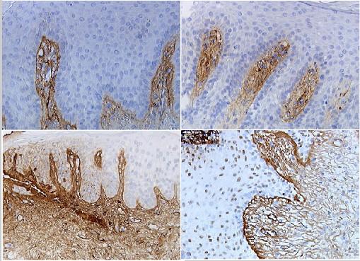 Distribution of ligonucleotide in Skin oligo follows perfused areas (stained brown); Topically