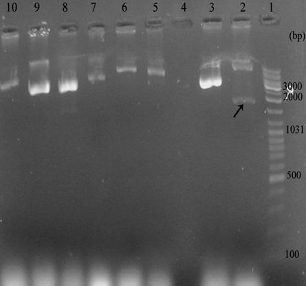 Digestion of the recombinant plasmid with Nhe I and Bam HI restriction enzymes. This plasmid was then electrophoresed on an 0.8% agarose gel.