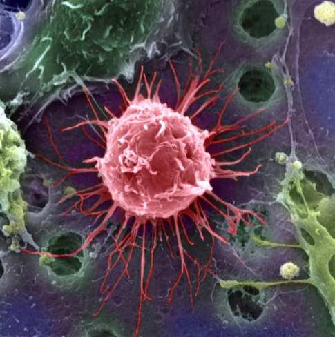 Stem Cell: Paul