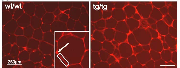 Tpm3.1 increases filamentous actin in