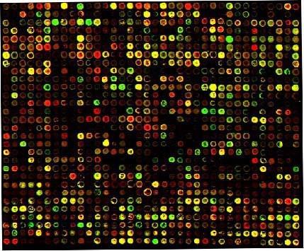 From data to functional interpretation Gene Expression Analysis Microarray Data Differential expression Preprocessing (Normalization, Scaling,