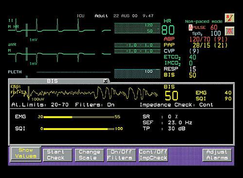 Health Care: Patient Monitoring Acting on patient vital sign data When a change in medication is followed by a rise