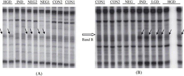 Protocol of ISSR PCR using radiolabel, is the most sensitive technique among