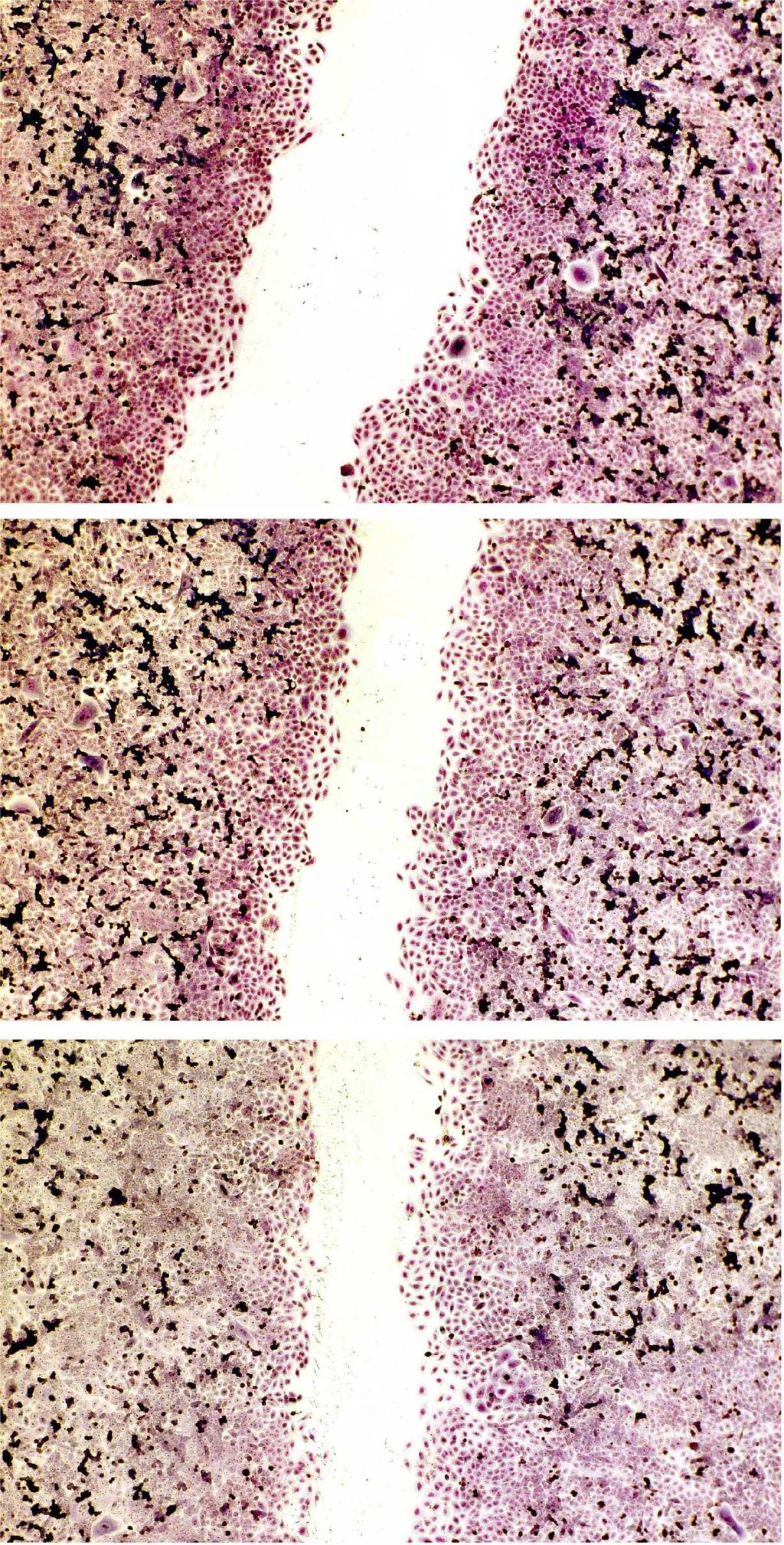 4 (5) Figure 1: Micrographs of stained cell cultures using bright field after 3 days of wound healing.