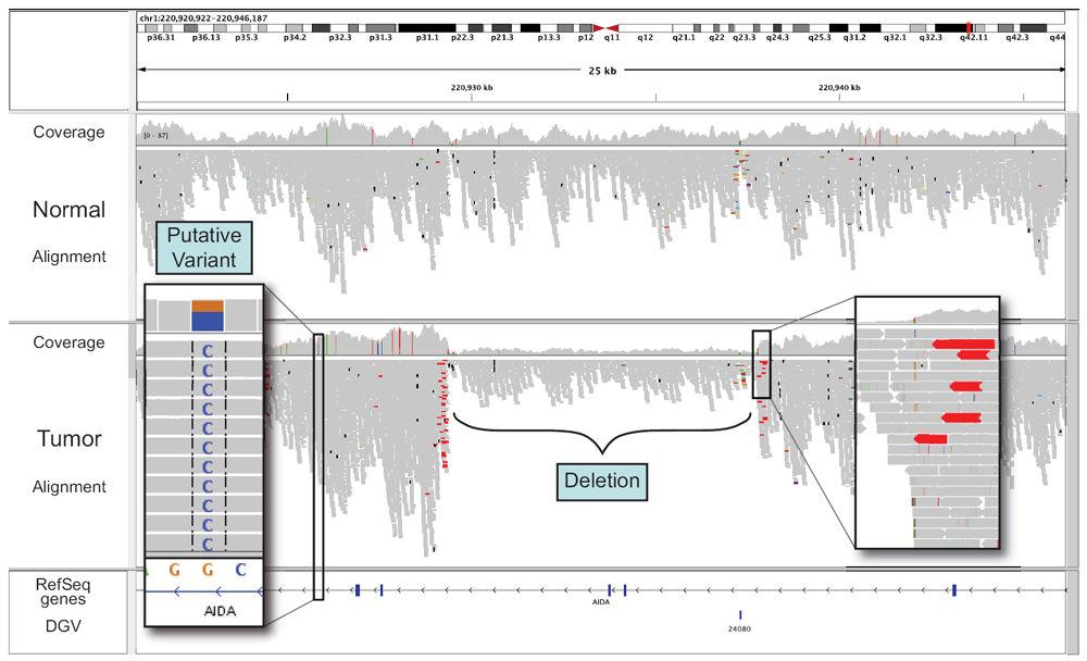 Robinson et al. Page 6 Figure 2. View of aligned reads at 20kb resolution Coverage plot and alignments from paired-end reads for a matched tumor/normal pair.