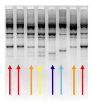 Genotypic Methods of Identifying Bacteria: PCR Bacterial DNA from a sample can be PCRed at a particular area in the genome Using restriction endonucleases the PCR producted are cut and an RFLP