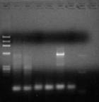 Inverse-PCR and