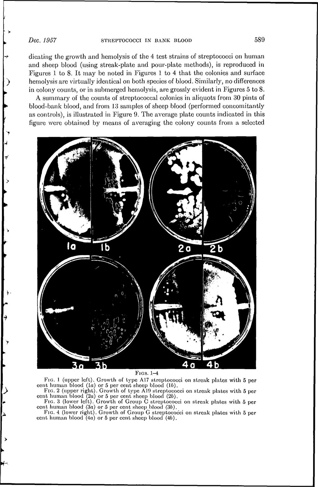Dec. 1957 STREPTOCOCCI IN BANK BLOOD 589 dicating the growth and hemolysis of the 4.