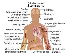 Biotechnology Why conduct stem cell research?