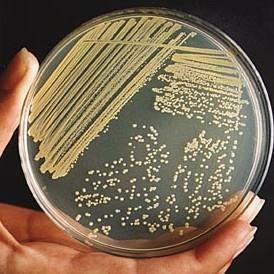 Micro Testing Programs (Verification) Clostridium perfringens - Press samples - Cooker verification