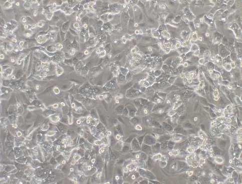 SECTION 3: CELL MORPHOLOGY - After 24 hurs f culture, hepatcyte-like cells appear in