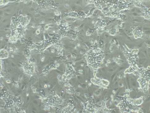 - 120-144 hurs after plating, hepatcyte-like cells are rganized in well-delineated