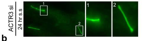 control and ACTR3-depleted cells with mature cilia after