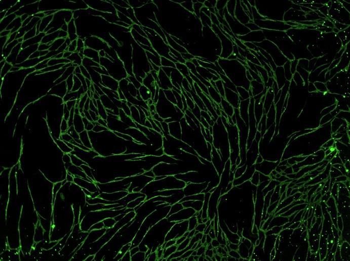 Angiogenesis Assay 150 NucLight Green Cnt/mm 2 100 50 0 0 100 200 300 400 Time (hrs) Tube Formation: HUVEC NucLight Green Cells in the Essen Angiogenesis Assay (CD31 label at Endpoint) Cell Line Mean