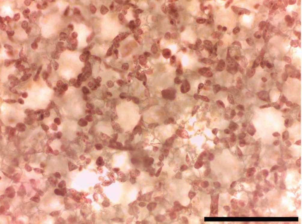 Figure 4. Close up view of Fig 3. Day 2 cells viewed by 20x objective.