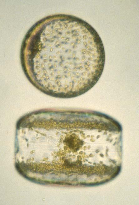 vacuole in diatoms gives buoyancy, exchange heavy