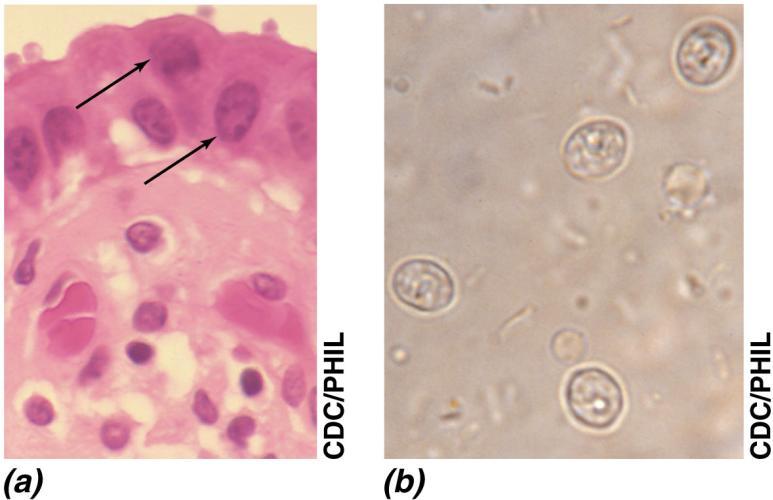 35.6 Giardiasis and Cryptosporidiosis Cryptosporidium parvum (Figure 35.