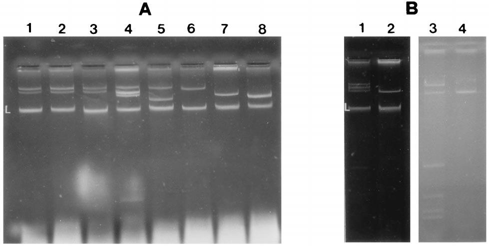 1502 DI MARTINO ET AL. J. CLIN. MICROBIOL. FIG. 1. Agarose gel electrophoresis of plasmid DNA from wild-type K. pneumoniae strains and corresponding E. coli transconjugants.