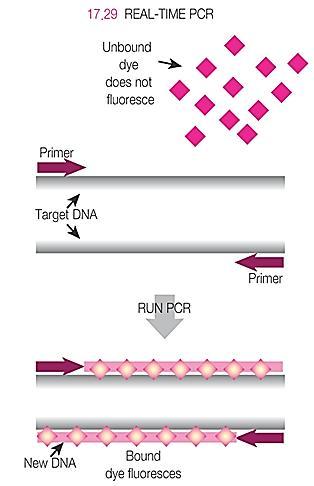 Real time PCR 1) Real time PCR: PCR where the synthesis of new DNA is monitored directly by using a fluorescent probe 2) Fluorescence indicates the amount of PCR product produced.