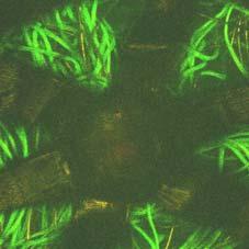 subsequently analysed using confocal microscopy. Images were taken of new dressings at each time point so that bacterial viability was not affected by prolonged contact with nucleic acid stains.