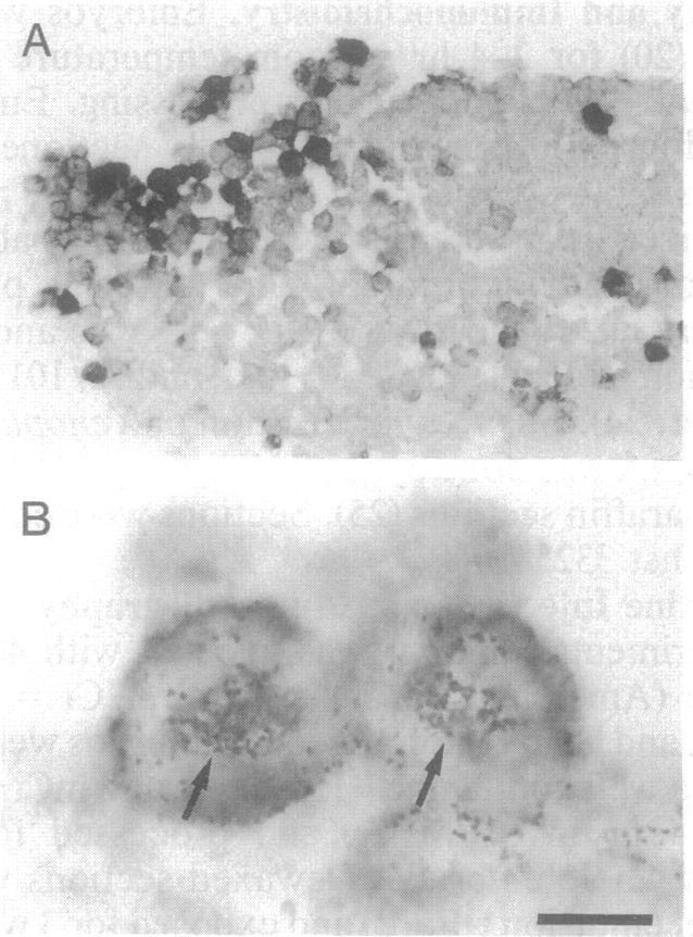 /s a- ^ -he 10846 Developmental iology: Holt et al. Table 1. MyoD expression in whole embryos after injection of nonfunctional (N-cadAE/C) or dominant negative (N-cadAE) N-cadherin RNA No.