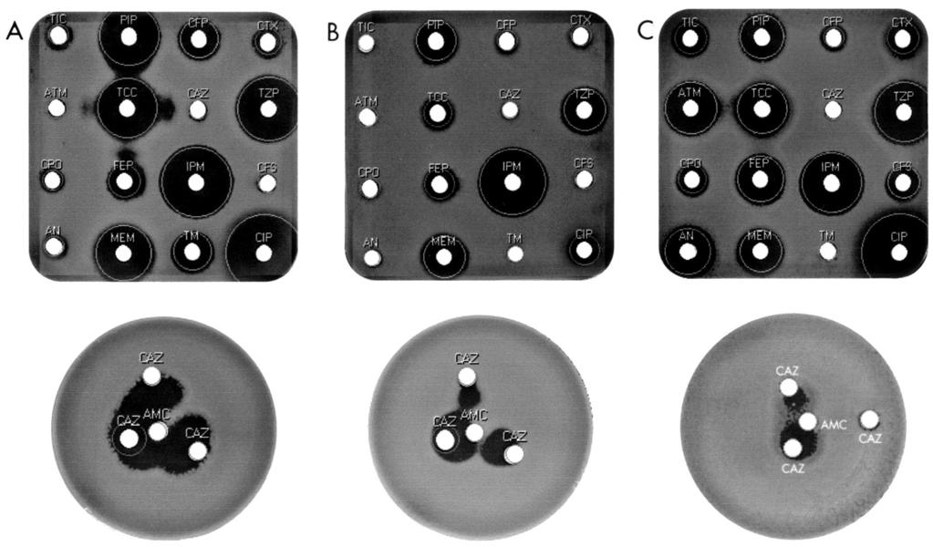 VOL. 41, 2003 PSEUDOMONAS AERUGINOSA -LACTAM PHENOTYPES 3717 FIG. 1. Detection of ESBL production by the double-disk diffusion test.