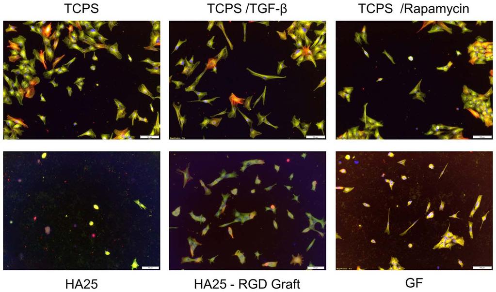 Fig. 7. LECs adhesion on RGD grafted disk in contrast with EMT inhibitor (Rapamycin) or promoter (TGF-b) treated cells on TCPS. (a-sma stained in red, tubulin in green, nucleus in blue) (bar 5100 mm).