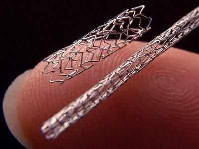 STUDY OF STENT DEFORMATION AND STRESS DEVELOPED AT