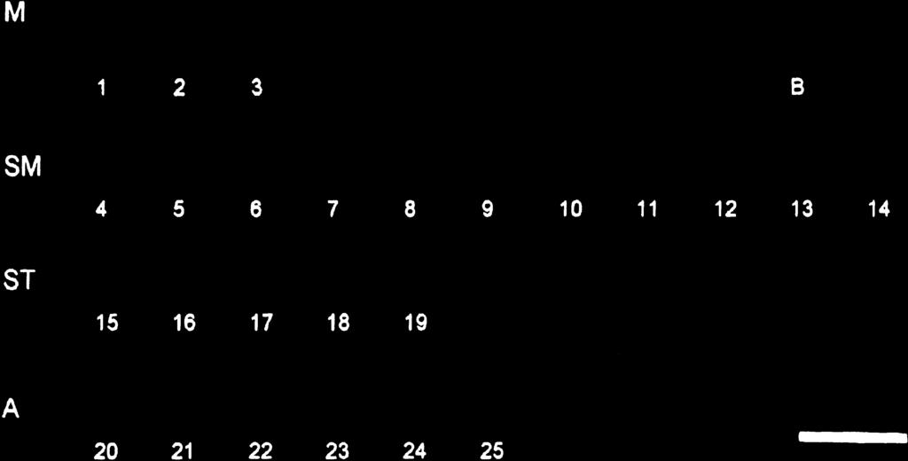 ISO-B-CHROMOSOMES IN FISH 3 Fig. 1 C-banding pattern of Astyanax scabripinnis. M, metacentric; SM, submetacentric; ST, subtelocentric and A, acrocentric chromosomes. Bar: 5 lm.