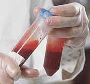 SECTION 5.3 HUMAN SOURCE MATERIAL HUMAN SOURCE MATERIAL Human Source Materials: Cells, blood, serum, tissues, feces, and body fluids (sputum, urine, saliva, etc.) originating from humans.