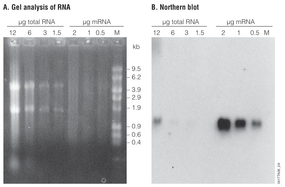 Techniques for RNA analysis: Northern Blotting Probe used is specific to