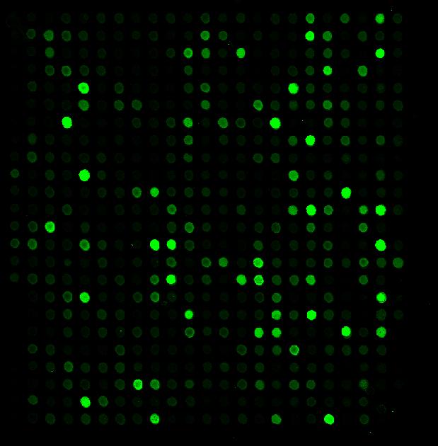 Techniques for RNA analysis: Microarrays for Gene Expression Profiling Normal lung sample was labeled with green dye The green fluorescent intensity of each