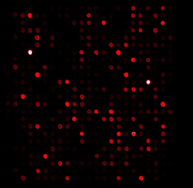 Techniques for RNA analysis: Microarrays for Gene Expression Profiling Lung tumor sample was labeled with red dye The red fluorescent intensity of each