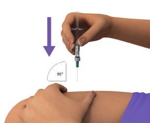 Giving your AVONEX injection (cont d) Step 8: With 1 hand, stretch the skin out around the injection site. With the other hand, hold the syringe like a pencil.