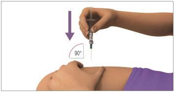 Step 8: With 1 hand, stretch the skin out around the injection site. With the other hand, hold the syringe like a pencil.
