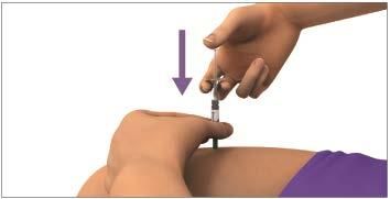 (Figure K) Step 10: Pull the needle out of the skin (See Figure L). Press down on the injection site with the gauze pad for a few seconds or rub gently in a circular motion.